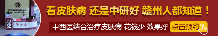 赣州中研白癜风医院预约